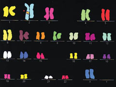 Coloured karyotype (Mr Pagkalos archive)